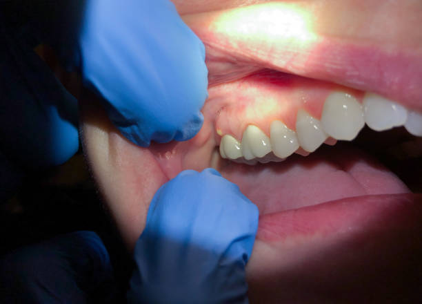 Best Walk-In Emergency Dentist in North Apollo, PA
