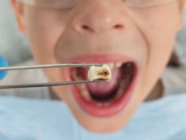 Best Same-Day Emergency Dentist in North Apollo, PA